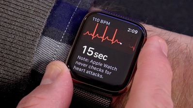 ECG apple watch